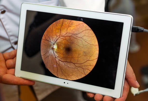 fundus camera price in India