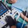 Buy Portable Ultrasound Machines