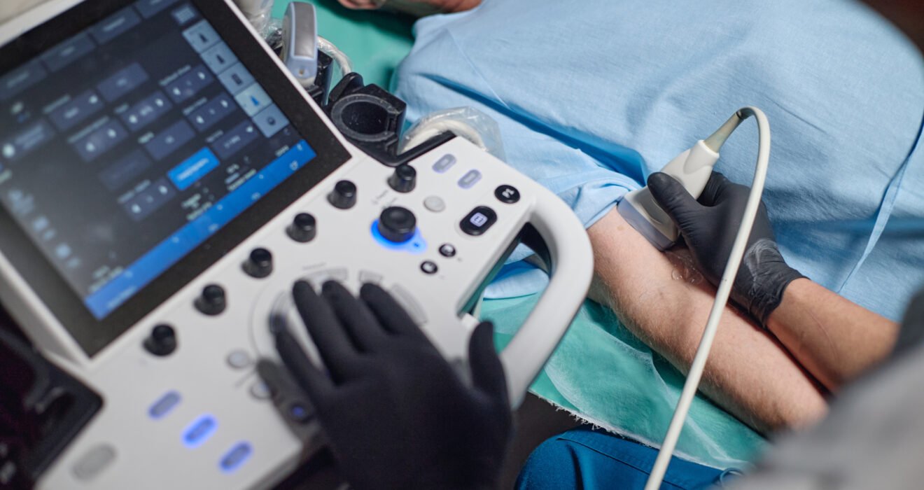 Buy Portable Ultrasound Machines