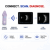 portable ultrasound machine, b-scan, medical equipment supplier