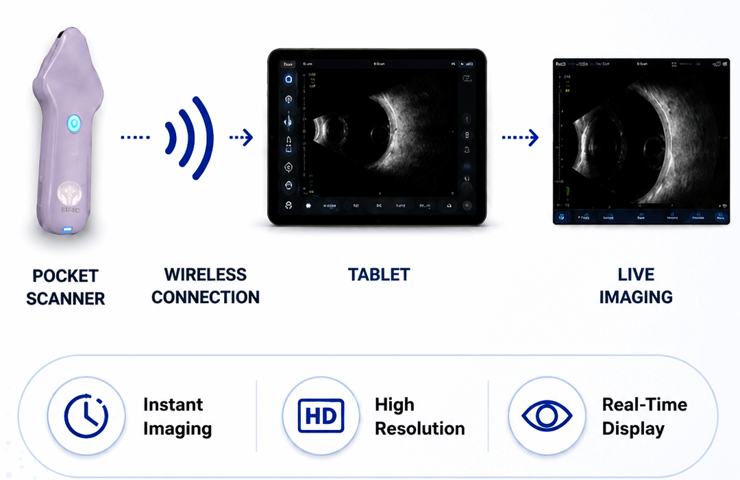 portable ultrasound machine, b-scan, medical equipment supplier