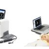 Suoer AB-Scan SW-2000 Review