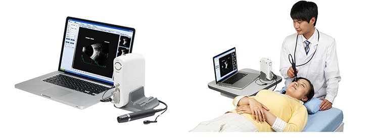 Suoer AB-Scan SW-2000 Review